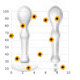 Upper limb defect eye and ear abnormalities