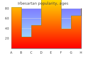 buy 300 mg irbesartan overnight delivery