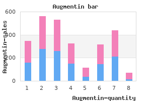 generic augmentin 625mg with amex