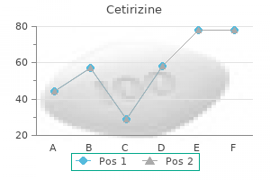 buy discount cetirizine 10 mg on-line