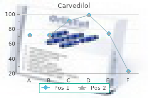 generic 25 mg carvedilol amex