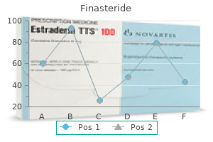 purchase 1 mg finasteride amex