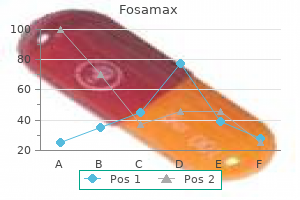 order 70mg fosamax otc