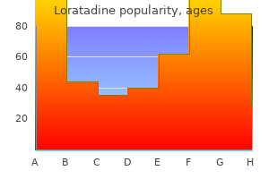 loratadine 10mg amex