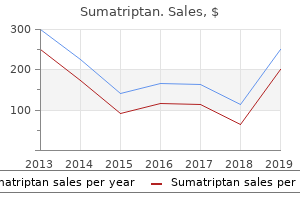 purchase sumatriptan on line amex