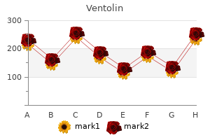 buy ventolin 100 mcg fast delivery