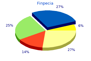 discount finpecia 1mg online