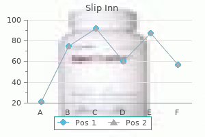 order slip inn with amex