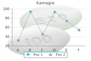 order genuine kamagra on-line