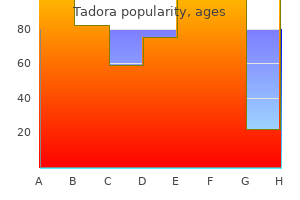 order tadora paypal